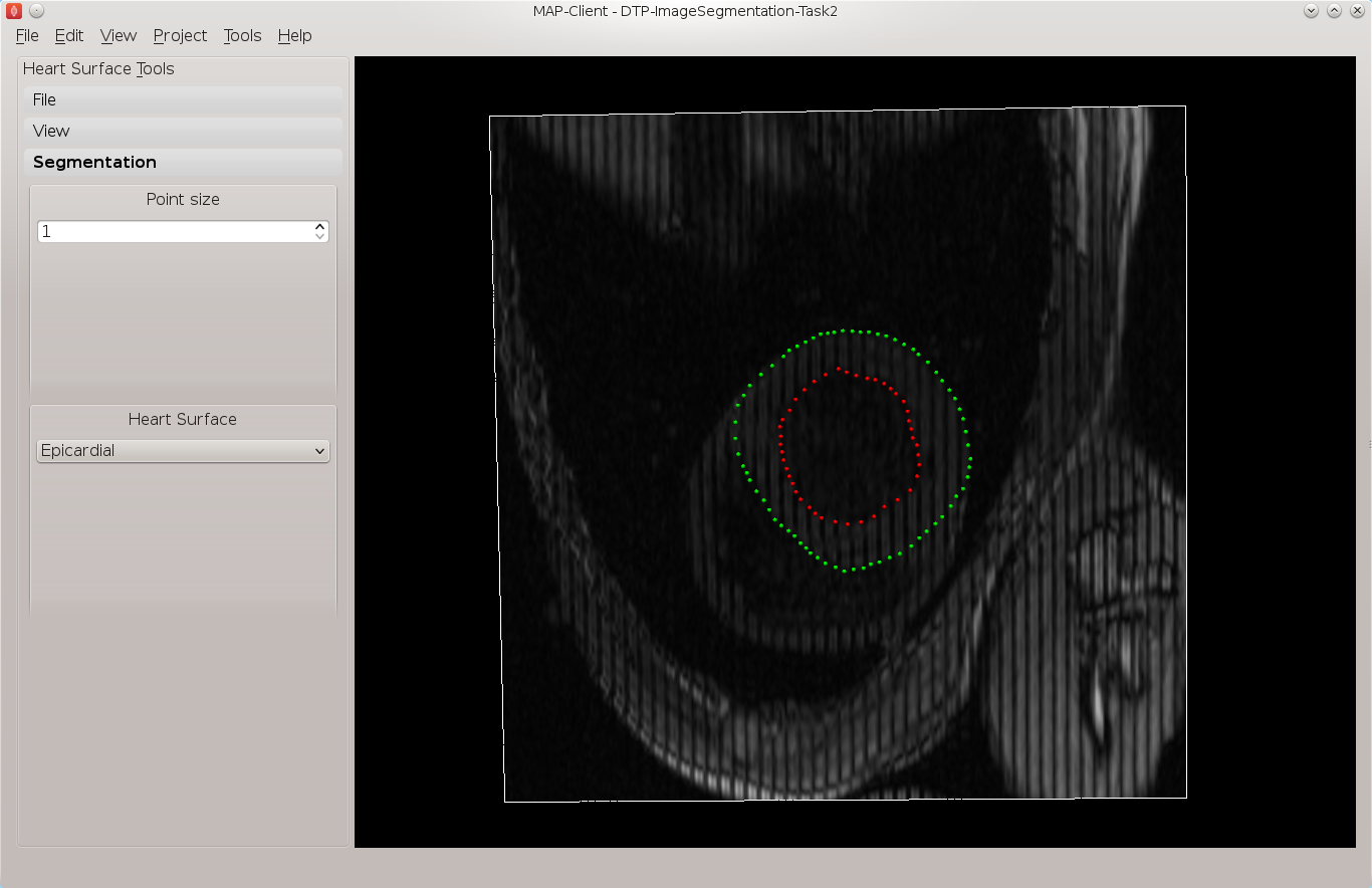 Task 2 segmented thirteenth image planes